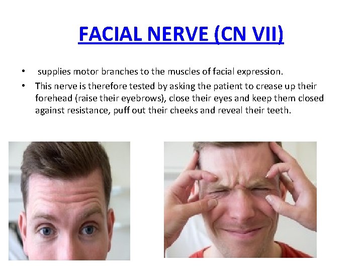 FACIAL NERVE (CN VII) • supplies motor branches to the muscles of facial expression.