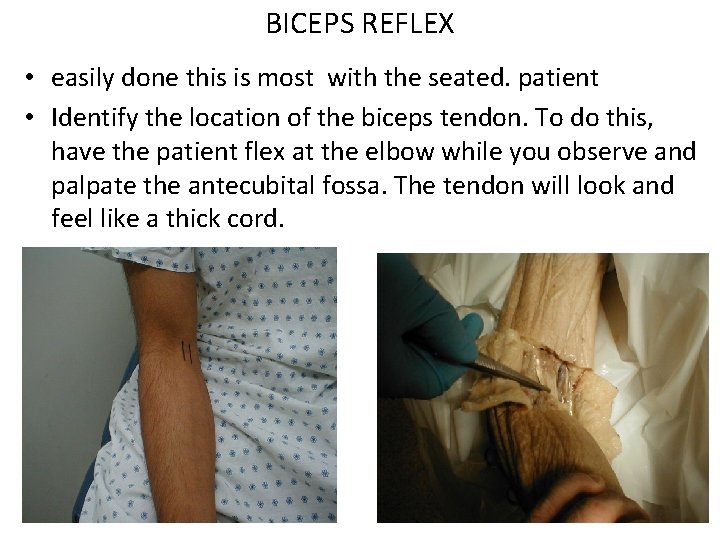 BICEPS REFLEX • easily done this is most with the seated. patient • Identify