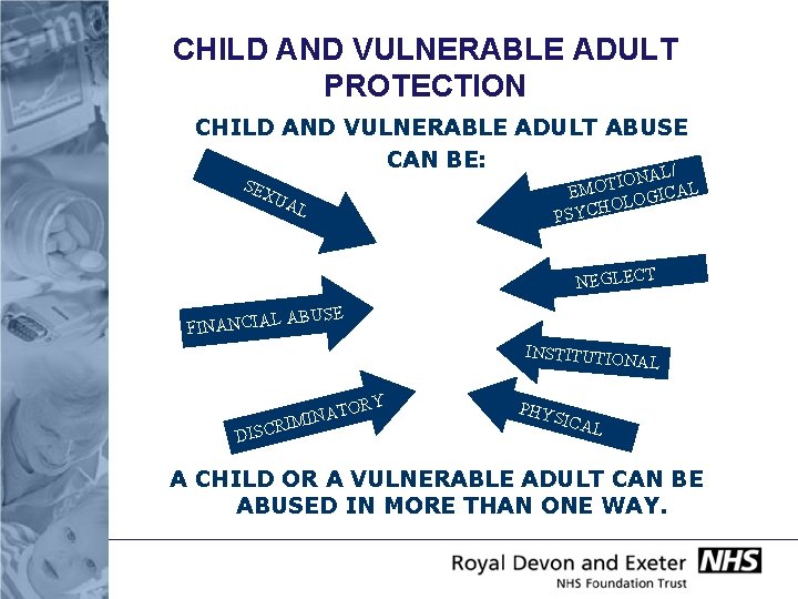 CHILD AND VULNERABLE ADULT PROTECTION CHILD AND VULNERABLE ADULT ABUSE CAN BE: SEX UA