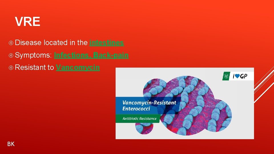 VRE Disease located in the intestines Symptoms: Infections, Back-pain Resistant to Vancomycin BK 