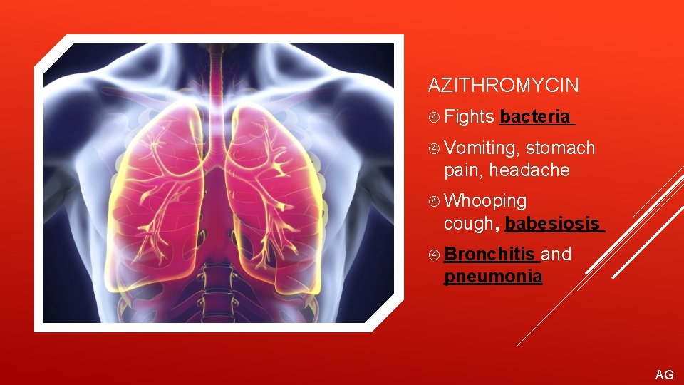 AZITHROMYCIN Fights bacteria Vomiting, stomach pain, headache Whooping cough, babesiosis Bronchitis and pneumonia AG