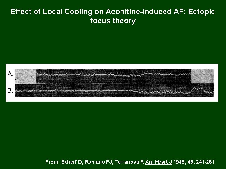 Effect of Local Cooling on Aconitine-induced AF: Ectopic focus theory From: Scherf D, Romano