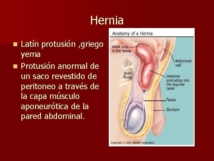 Hernia Latín protusión , griego yema n Protusión anormal de un saco revestido de