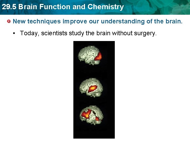 29. 5 Brain Function and Chemistry New techniques improve our understanding of the brain.