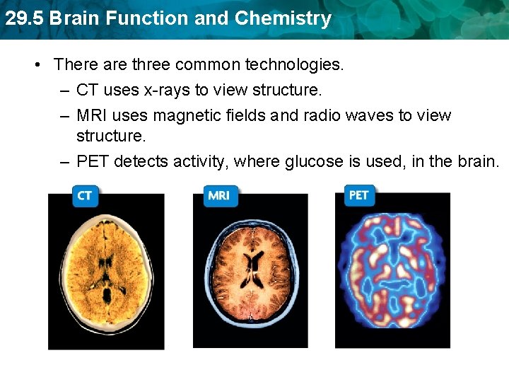 29. 5 Brain Function and Chemistry • There are three common technologies. – CT
