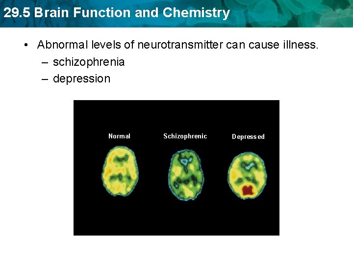 29. 5 Brain Function and Chemistry • Abnormal levels of neurotransmitter can cause illness.