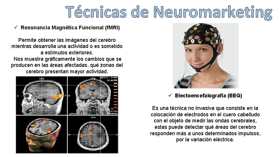 Técnicas de Neuromarketing ü Resonancia Magnética Funcional (f. MRI) Permite obtener las imágenes del