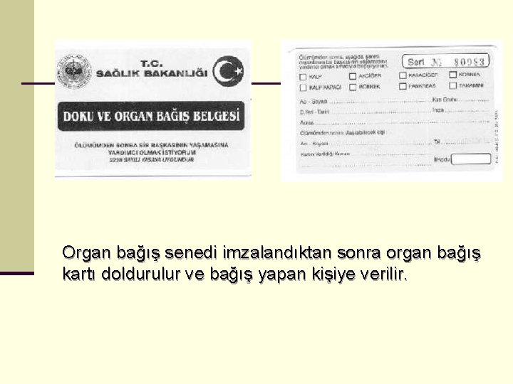 Organ bağış senedi imzalandıktan sonra organ bağış kartı doldurulur ve bağış yapan kişiye verilir.