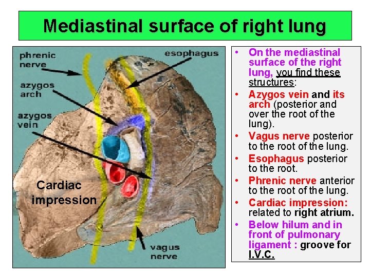 Mediastinal surface of right lung Cardiac impression • On the mediastinal surface of the