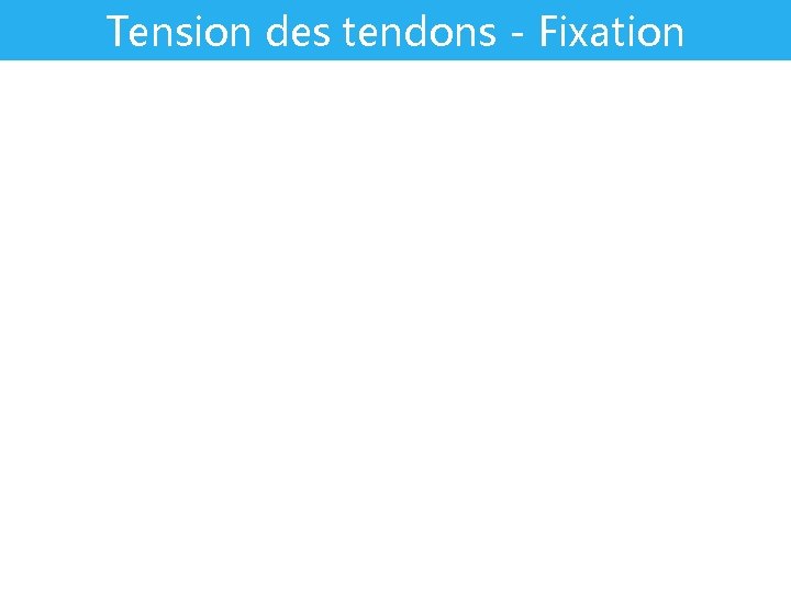 Tension des tendons - Fixation 
