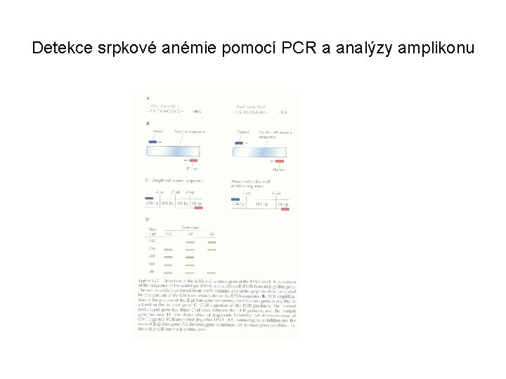 Detekce srpkové anémie pomocí PCR a analýzy amplikonu 