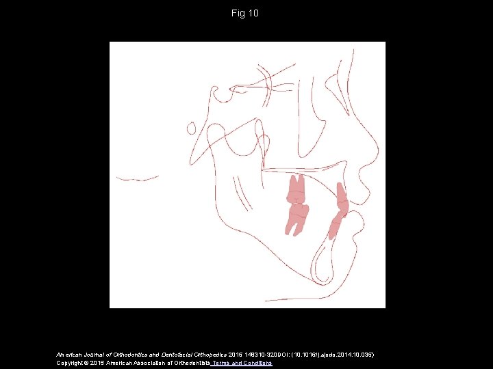 Fig 10 American Journal of Orthodontics and Dentofacial Orthopedics 2015 148310 -320 DOI: (10.