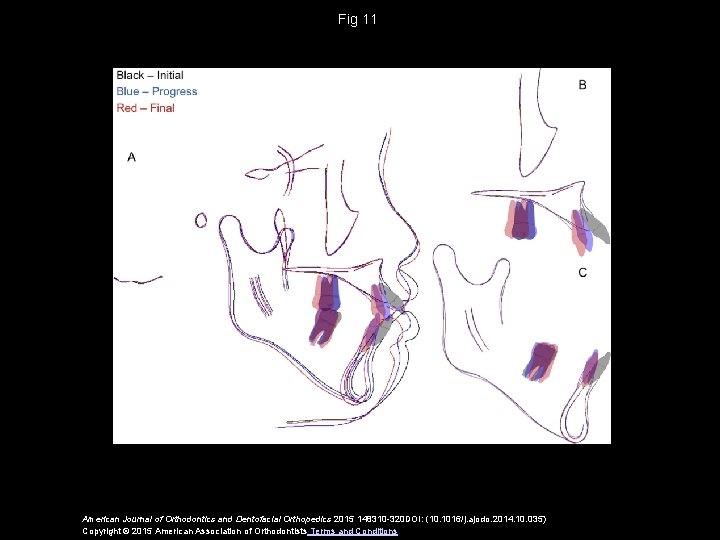 Fig 11 American Journal of Orthodontics and Dentofacial Orthopedics 2015 148310 -320 DOI: (10.