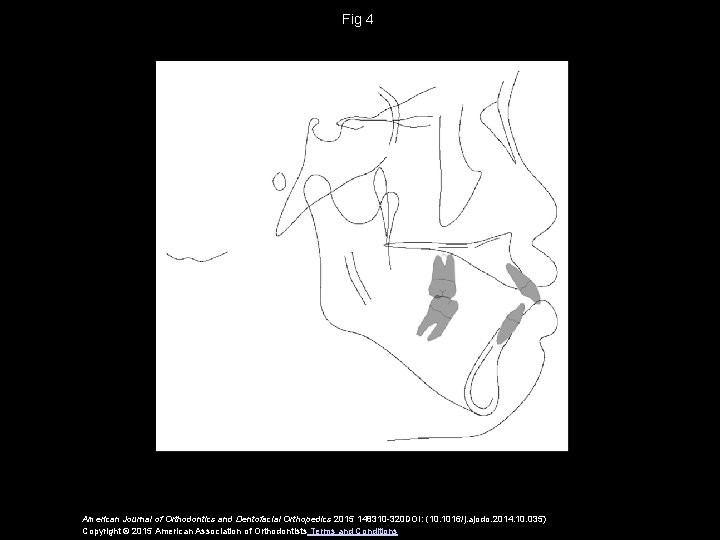 Fig 4 American Journal of Orthodontics and Dentofacial Orthopedics 2015 148310 -320 DOI: (10.