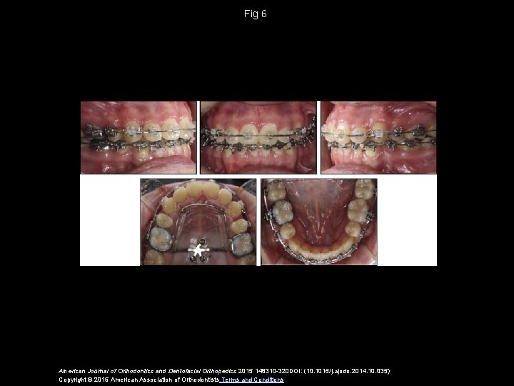 Fig 6 American Journal of Orthodontics and Dentofacial Orthopedics 2015 148310 -320 DOI: (10.