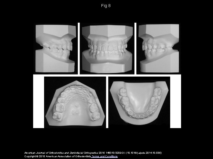 Fig 8 American Journal of Orthodontics and Dentofacial Orthopedics 2015 148310 -320 DOI: (10.
