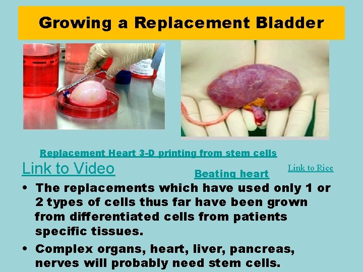 Growing a Replacement Bladder Replacement Heart 3 -D printing from stem cells Link to