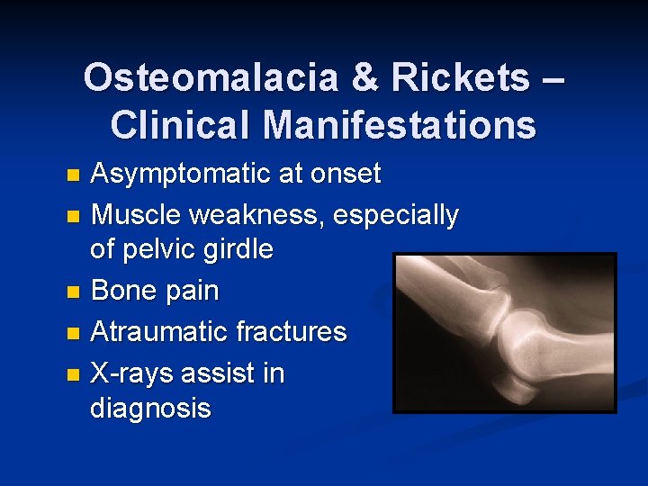 Osteomalacia & Rickets – Clinical Manifestations Asymptomatic at onset n Muscle weakness, especially of