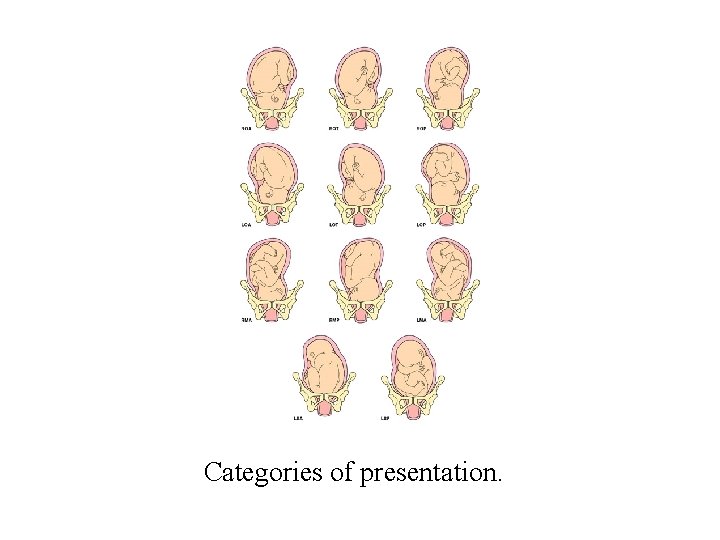 Categories of presentation. 