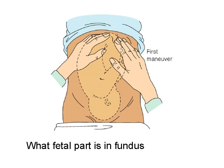 What fetal part is in fundus 