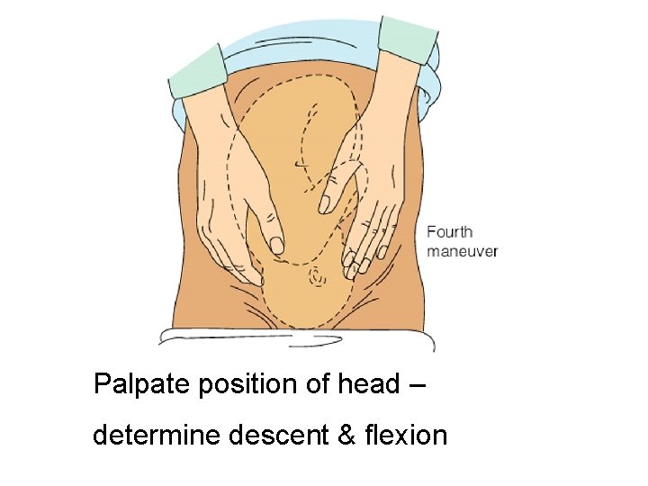 Palpate position of head – determine descent & flexion 