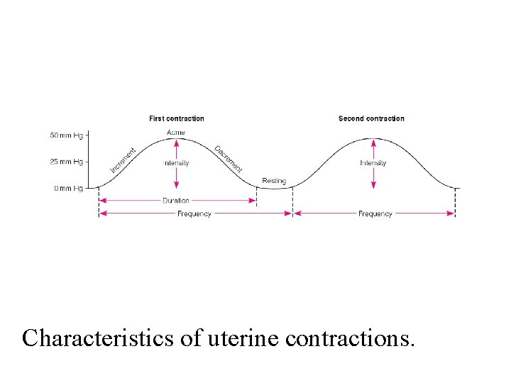 Characteristics of uterine contractions. 