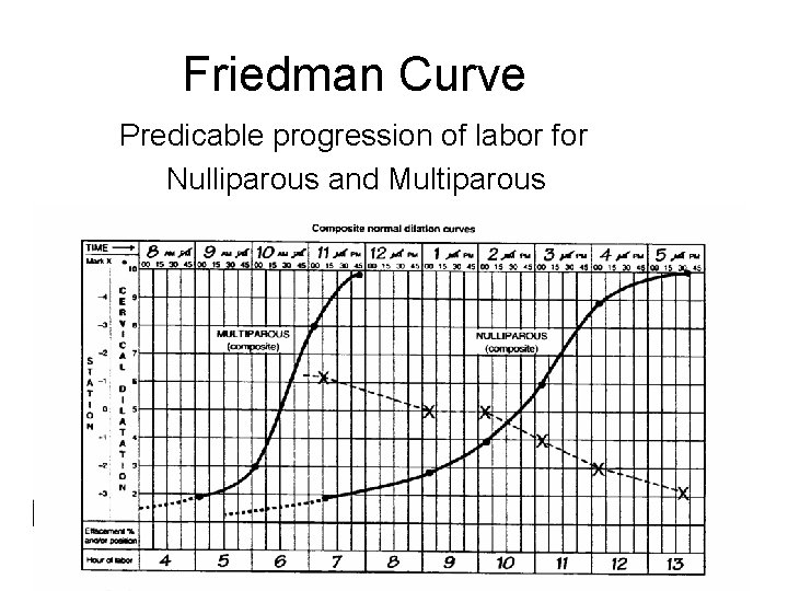 Friedman Curve Predicable progression of labor for Nulliparous and Multiparous 