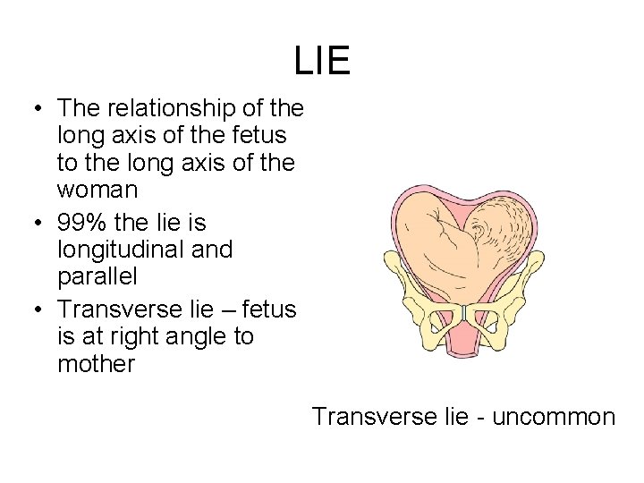 LIE • The relationship of the long axis of the fetus to the long