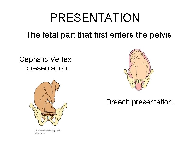 PRESENTATION The fetal part that first enters the pelvis Cephalic Vertex presentation. Breech presentation.