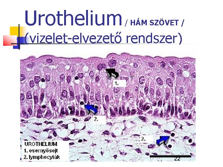 Urothelium / HÁM SZÖVET / (vizelet-elvezető rendszer) 22 