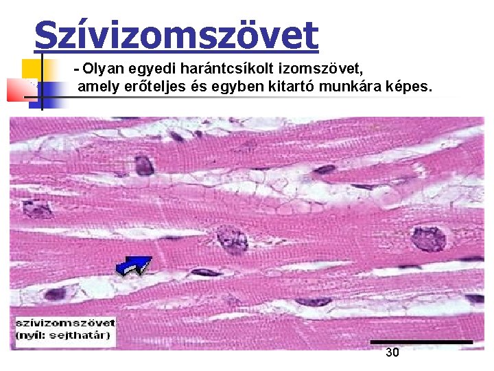 Szívizomszövet - Olyan egyedi harántcsíkolt izomszövet, amely erőteljes és egyben kitartó munkára képes. 30