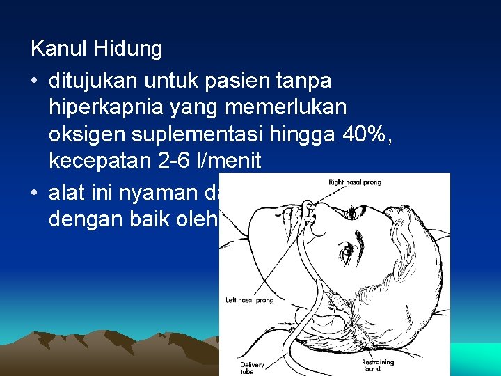 Kanul Hidung • ditujukan untuk pasien tanpa hiperkapnia yang memerlukan oksigen suplementasi hingga 40%,