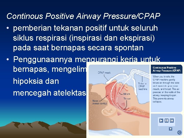 Continous Positive Airway Pressure/CPAP • pemberian tekanan positif untuk seluruh siklus respirasi (inspirasi dan