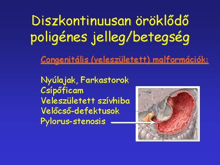 Diszkontinuusan öröklődő poligénes jelleg/betegség Congenitális (veleszületett) malformációk: Nyúlajak, Farkastorok Csípőficam Veleszületett szívhiba Velőcső-defektusok Pylorus-stenosis