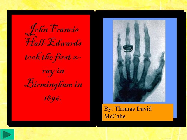 John Francis Hall-Edwards took the first xray in Birmingham in 1896. By: Thomas David