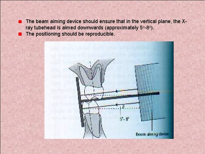 The beam aiming device should ensure that in the vertical plane, the Xray tubehead