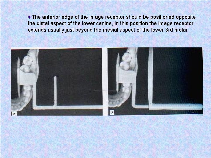 The anterior edge of the image receptor should be positioned opposite the distal aspect