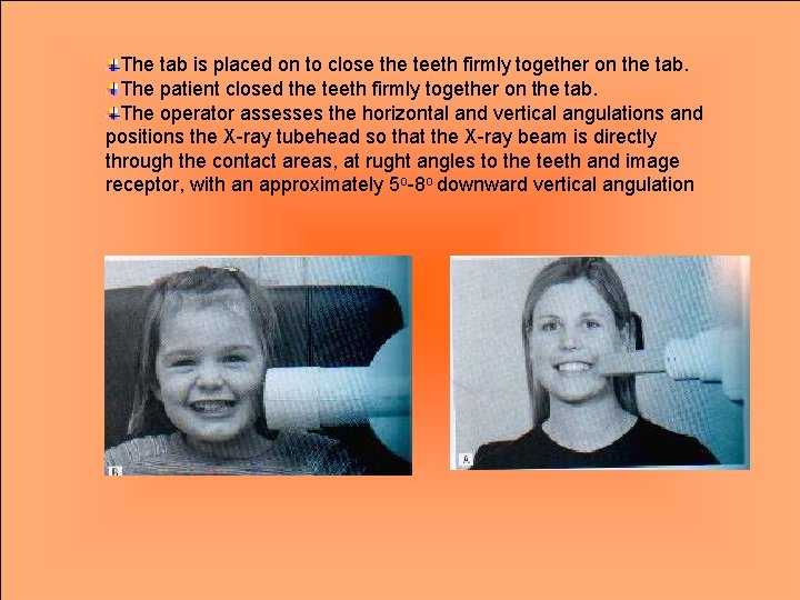 The tab is placed on to close the teeth firmly together on the tab.