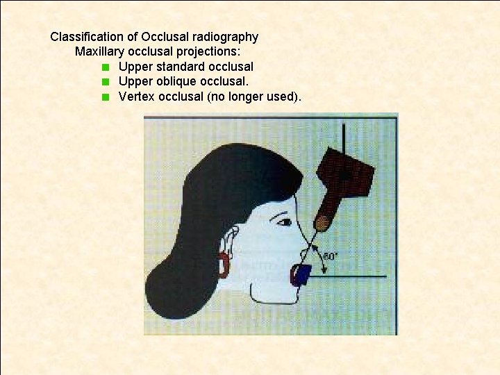 Classification of Occlusal radiography Maxillary occlusal projections: Upper standard occlusal Upper oblique occlusal. Vertex
