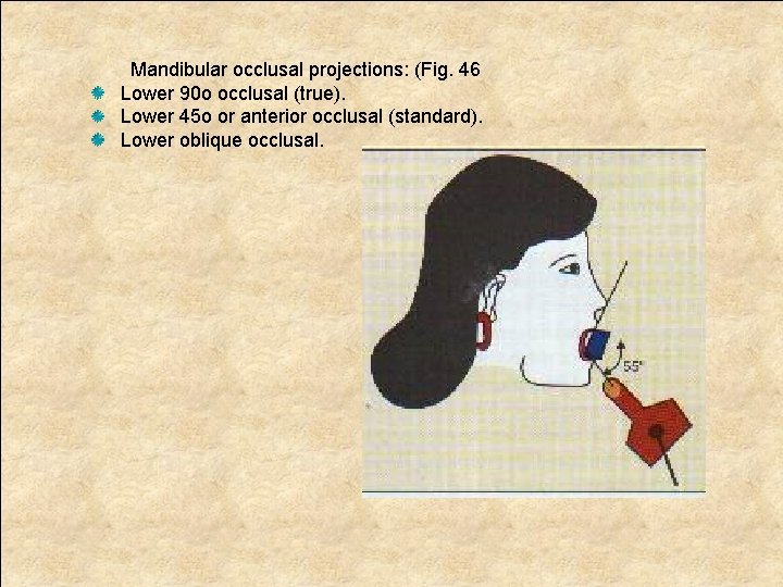 Mandibular occlusal projections: (Fig. 46 Lower 90 o occlusal (true). Lower 45 o or