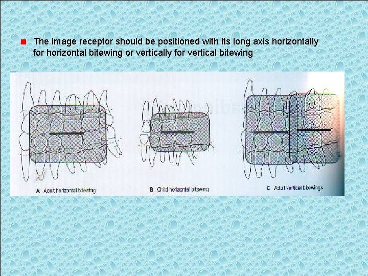 The image receptor should be positioned with its long axis horizontally for horizontal bitewing
