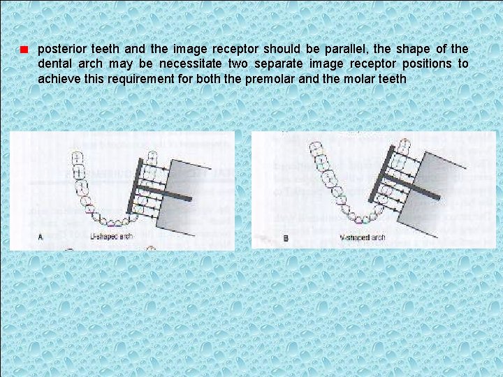 posterior teeth and the image receptor should be parallel, the shape of the dental