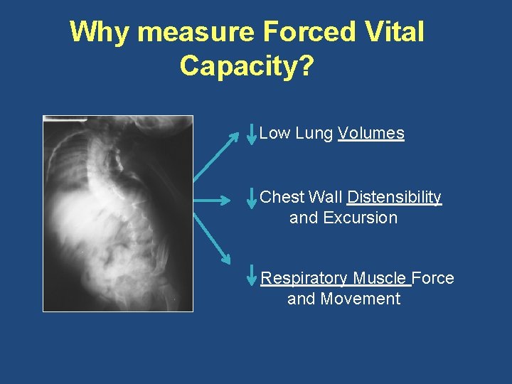 Why measure Forced Vital Capacity? Low Lung Volumes Chest Wall Distensibility and Excursion Respiratory