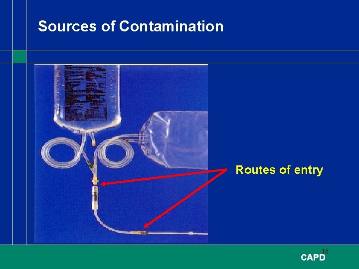 Sources of Contamination Routes of entry 16 CAPD 