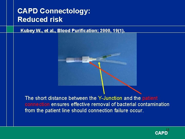 CAPD Connectology: Reduced risk Kubey W. , et al. , Blood Purification; 2000, 19(1).