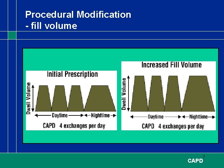 Procedural Modification - fill volume 7 CAPD 