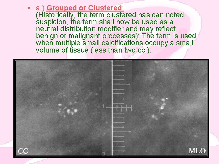  • a. ) Grouped or Clustered: (Historically, the term clustered has can noted