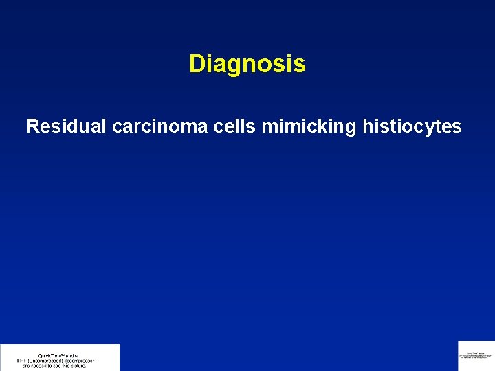 Diagnosis Residual carcinoma cells mimicking histiocytes 
