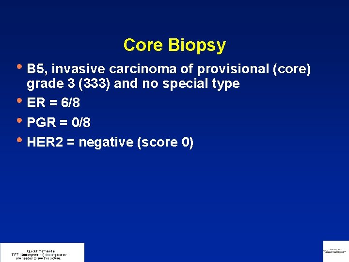 Core Biopsy • B 5, invasive carcinoma of provisional (core) • • • grade