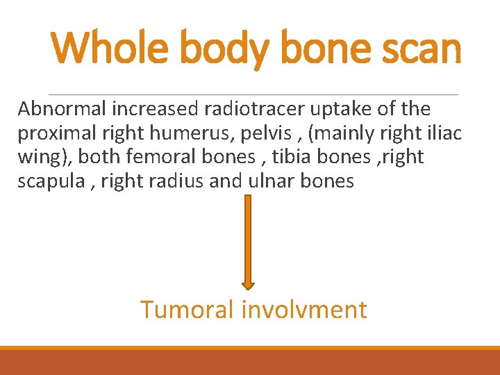 Whole body bone scan Abnormal increased radiotracer uptake of the proximal right humerus, pelvis